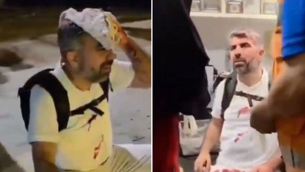Uluslararası Refah Yürüyüşüne katılmıştı! HÜDA-PAR Milletvekili Faruk Dinç başından yaralandı - Gündem