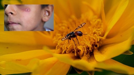 Yaraya benziyor ama öldürebiliyor! Sinsi tehlike “Yakarca” sineği o illerde görülüyor - Gündem