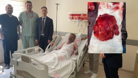 Uzmanlar “nadir görülür” dedi, kimse ameliyat etmek istemedi! Böbreğinden çıkan şoke etti - Gündem