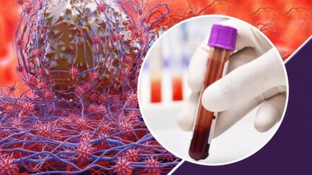 Kanseri 3 yıl önceden tespit eden kan testi geliştirildi! - Dünya