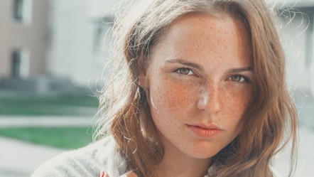 Her leke masum değildir! Cilt kanseri olabilir - Sağlık