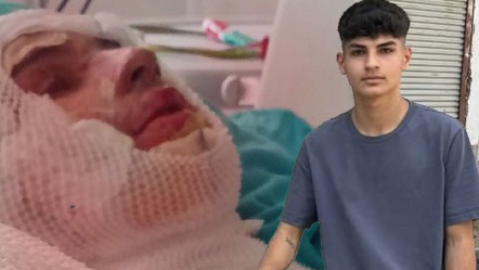 Adana'da aile içinde kan donduran plan! 16 yaşındaki yeğenini yakan adamın yalanı pes dedirtti - 3. Sayfa