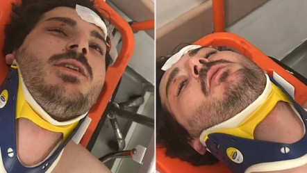 Otobanda durduruldu, feci şekilde darbedildi! Oyuncu Mehmet Akif Akdeniz’den kan donduran açıklama - Magazin