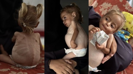 Gazze'de açlıktan ölen çocuk sayısı artıyor! 2 yaşındaki Şam’ın annesi yardım istedi - Dünya
