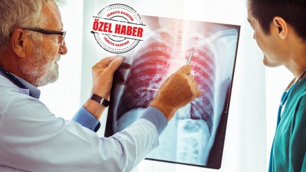 Bronşektazi az biliniyor, geç teşhis ediliyor! Geçmeyen öksürüğü hafife almayın… - Yaşam
