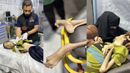İsrail, bir genci daha açlıktan öldürdü! - Dünya