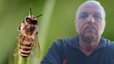 Arı sokması deyip geçmeyin! Anafilaktik şoka girdi, hayatını kaybetti! - Gündem