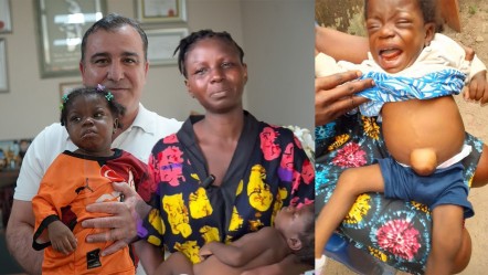Türkiye, onlara umut oldu! Bir annenin çaresiz bekleyişi Antalya’da son buldu - Sağlık