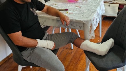 Sokak köpeği ayağını dakikalarca bırakmadı! Hem çatlak hem de kırık var - Gündem