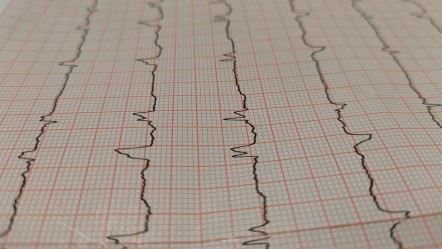 Kalp krizi sanılıyor, stres kaynaklı çıkıyor: Orta yaşlılar risk altında - Sağlık