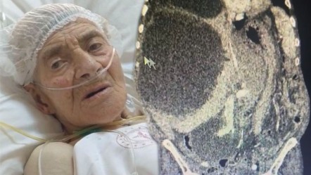 Ağrı ve şişlik şikayetiyle başvurdu! Meğer kedi köpekten bulaşmış, karnını doldurmuş - SAĞLIK
