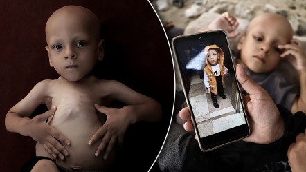 Çaresiz anne ne yapacağını şaşırdı! 5 yaşındaki çocuğu için çağrıda bulundu - Dünya