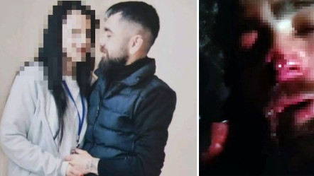 Vahşetin böylesi! Eski sevgilisine işkence yaptırdı, kulağı ve burnu koptu - 3. Sayfa