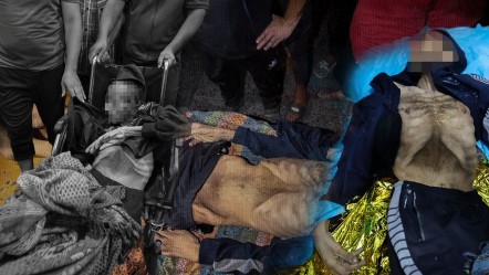 İnsanlığı utandıran kare! Açlık silahı bir can daha aldı, 35 yaşındaki adam bir deri bir kemik öldü - Dünya