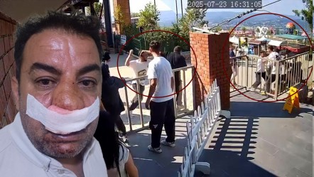 Turistleri savundu, üstüne çullandılar! Kartepe'de dolandırıcılığı önleyen şoför hastanelik oldu - Gündem