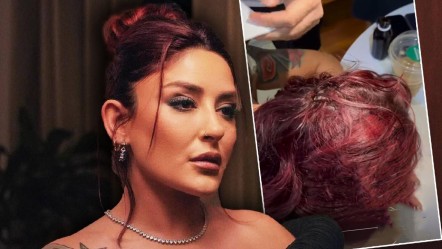 Talihsiz kaza! Ünlü şarkıcı Melek Mosso kafa üstü düştü: “Lütfen dua edin" - Magazin