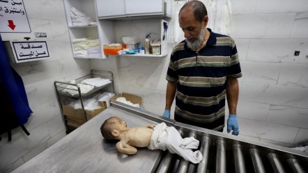 Tarih böyle vahşet görmedi! İsrail ablukası altında Gazze'de 14 kişi daha açlıktan hayatını kaybetti! - Dünya