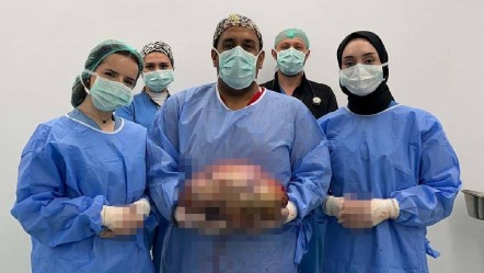 Hamile sanıldı, gerçek ortaya çıkınca herkes şok oldu: Bakın karnından ne çıktı... - Yaşam