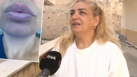 İki ülkede doktor doktor gezdi, çare bulamadı: Dilinin yapısı bile değişti! Nedeni pes dedirtti - Yaşam