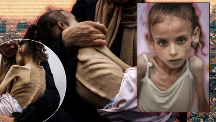 25 kilodan 10 kiloya düştü... Küçük Meryem, dünyanın gözleri önünde açlıktan eriyor - Dünya