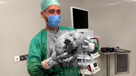 30 santimetre çapında, 4 kilo ağırlığında! Yaşlı kadın bir saatte kurtuldu - Yaşam