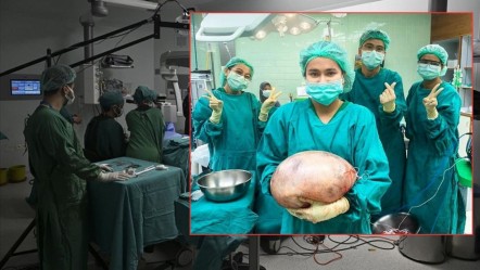 Şişkinlik ve nefes alamama şikayetiyle başvurmuştu! Karnından çıkan doktorları bile hayrete düşürdü - Dünya