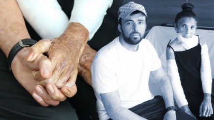 Düğüne 3 gün kala dehşeti yaşadılar! Patlamada kapanan elleri 3 yıl sonra yeniden kavuştu - Sağlık