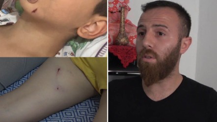 Başıboş sokak köpeği dehşeti! Babasının yanında küçük çocuğu art arda ısırdı - Gündem