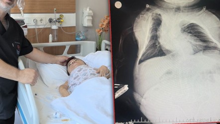 Karın ağrısı sandı, 3 kilogramlık kist çıktı! Akondroplazi hastası kadın sağlığına kavuştu - Sağlık