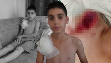 Köpek kolunu parçalamıştı! Küçük çocuğun sağ kolu felç kaldı... Aile adalet arıyor - 3. Sayfa