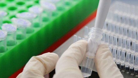 Tamamlayıcı ve geleneksel tıp için laboratuvar geliyor - Sağlık