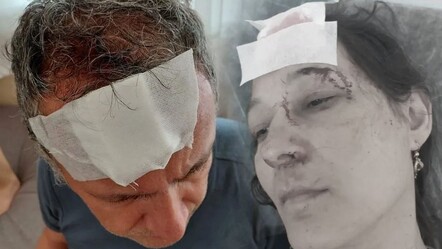 Yazlıkta 'aidat' dehşeti! Demir sopalarla acımazca dövüldüler - Gündem