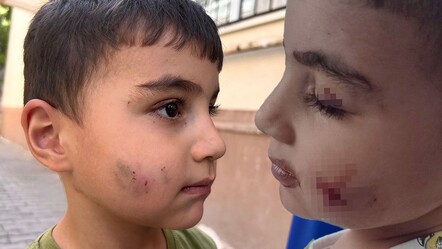 Evde uyurken farenin ısırığıyla uyandı! Küçük çocuk dehşeti yaşadı: Kanı durduramadılar - 3. Sayfa