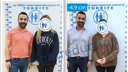 Yabancı kadınlar arasında akılalmaz trend! Boylarını kısaltmak için Türkiye'ye akın ediyorlar - Dünya