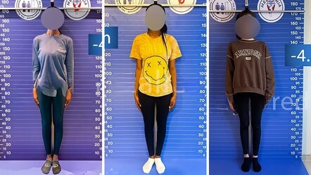 Yabancı kadınlar arasında akılalmaz trend! Boylarını kısaltmak için Türkiye'ye akın ediyorlar - Dünya
