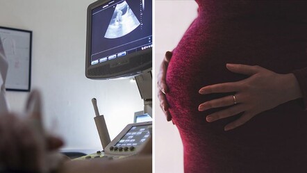 Tıp dünyası bu vakayı konuşuyor Karaciğerinde 12 haftalık bebek... - Dünya