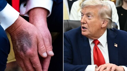 Trump kayboldu mu? Hastalandı iddiası ABD’yi karıştırdı! Başkan’a ulaşılamıyor - Dünya
