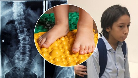 Sadece omurga değil, ayaklar da tehlikede! Uzmanlardan uyardı: Her yıl söyleniyor ama veliler dikkat etmiyor - Eğitim