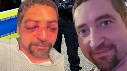 Trafikte dehşet anları! İşten eve dönüyordu: Önünü kesip gözlerini oydu - Dünya
