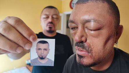 İnternetten aldığı şampuan hayatını kararttı! “Gözlerimi kaybedeceğim diye korktum” - Yaşam