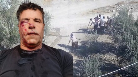 Kafasını taşla ezmek istediler! Kocasını akrabalarından böyle kurtardı - 3-sayfa