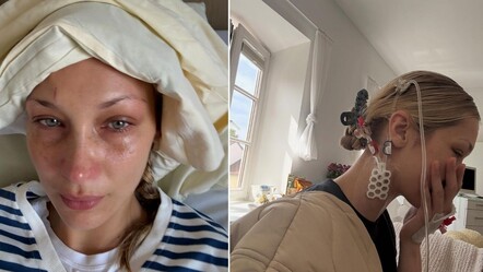 Bella Hadid’in hastalığı Lyme nedir, belirtileri neler? İşte merak edilenler - Haberler