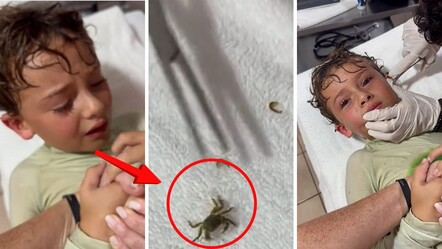 Meksika'da deniz keyfi kabusa dönüştü! Kulağından çıkan doktorları bile şaşkına çevirdi - Dünya