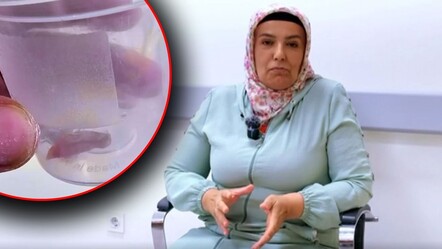 1,5 yıldır öksüren hastanın akciğerinde kabak çekirdeği çıktı! Hemen operasyona alındı - Yaşam