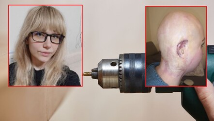 İngiltere'de iş yerinde saçı matkaba dolanmıştı! Genç anneye rekor tazminat - dunya