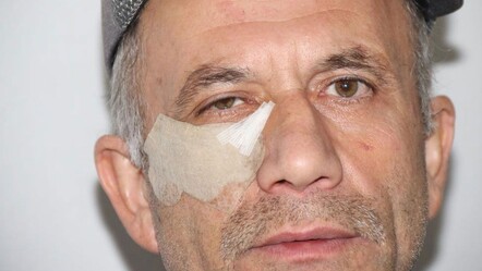 Cami yolunda dehşet: Komşusu darp etti! “Elmacık kemiğim çökmüş” - 3. Sayfa