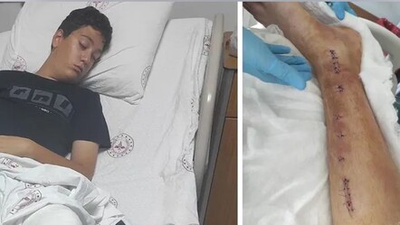 Başına poşet geçirilen öğrenci ayağını kırdı: Okul, "Kibar çocuk yetiştirmişsiniz" deyip aileyi suçladı - 3. Sayfa