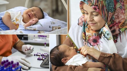 6 milyonda bir görülüyor, Türkiye'de ilk! 'Altın kan' anne-bebeği kurtardı - Yaşam
