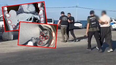 Bitlis'te polisi şaşkına çeviren operasyon: Midelerinden kapsül kapsül uyuşturucu çıktı! - 3. Sayfa