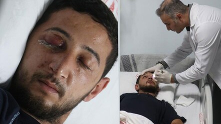 Düğünde havai fişek faciası: Gözünde patladı! "Bitti zannetmiştim" - 3. Sayfa